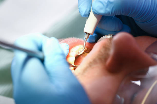 Best Walk-In Emergency Dentist in Trophy Clu, TX