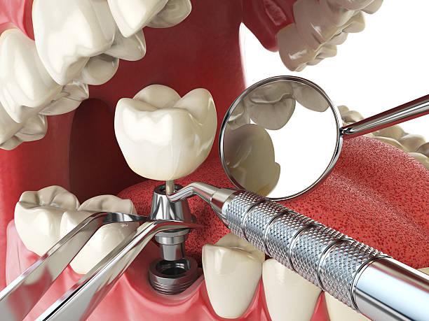 Best Emergency Broken Tooth Repair in Trophy Clu, TX